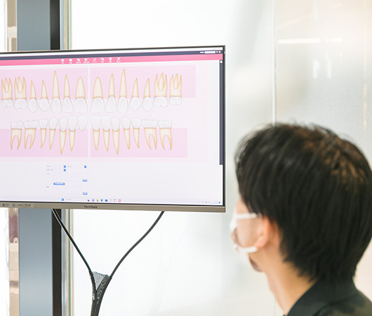 治療前の歯並びシミュレーション